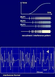 Image result for Nexus 4 Biotracer EMG Waveform