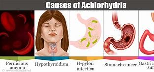 Image result for aclodhidria
