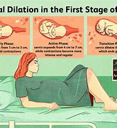 Image result for What Does Two Cm Dilated Look Like Pictures