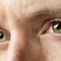 Image result for Person with Green Eyes