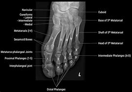 Image result for Right Foot X-ray