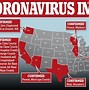 Image result for New York Quarantine California