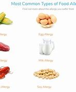 Image result for Common Food Allergies