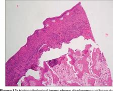 Image result for Histopathology Artifacts