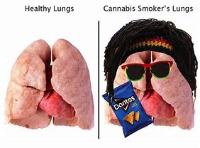 Image result for Weed Lungs Meme