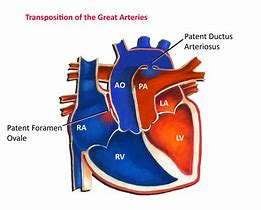Image result for Right Subclavian Artery Anatomy