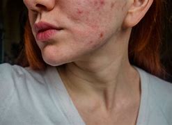 Image result for dermatolog�a