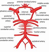 Image result for Arteries Anterior Middle Posterior Cerebral Basilar Internal Carotid Vertebral