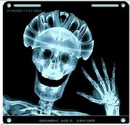 Image result for X-ray of a Motorcycle