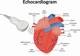 Image result for Echocardiogram Mercedes Sign