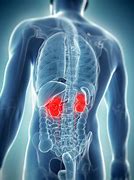 Image result for Renal Cysts On Kidneys