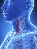 Image result for Picture of Carotid Artery Location