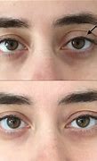 Image result for Make Eyelids Look Smaller
