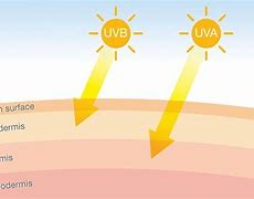 Image result for UVA Sun Burn