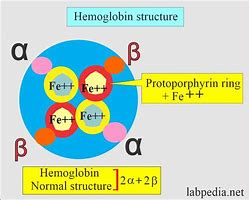 Image result for Hemoglobin H