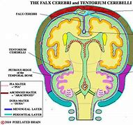 Image result for CSF Cisterns