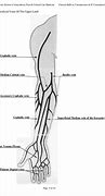 Image result for IV Cannula Site