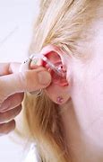 Image result for Hearing Aid Fitting