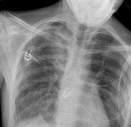 Image result for Pneumostat XR