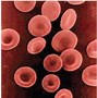 Image result for Hemoglobin H