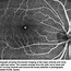 Image result for Retina Layers Diagram