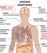 Image result for acaeemia