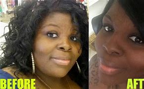 Image result for 50 Pound Weight Loss