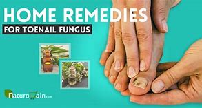 Image result for Natural Nail Fungus Treatment | Forces Of Nature Medicine, 30Ml
