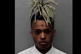 Image result for Xxxtentacion Hair Growth