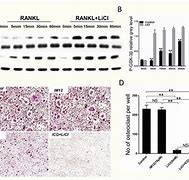 Image result for Lithium Chloride