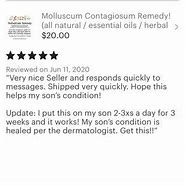 Image result for Molluscum Contagiosum Essential Oil