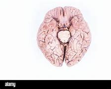 Image result for Live Human Brain