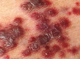 Image result for co_to_za_ziarnica