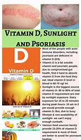 Image result for Psoriasis Treatment Diet