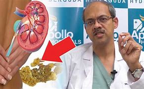 Image result for Surgery for Kidney Stones