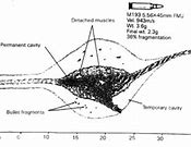 Image result for 5.56 Wound Cavity