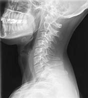 Image result for Chiropractor Neck