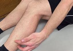 Image result for Peroneal Nerve Knee Pain