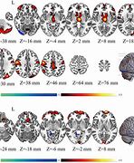 Image result for Men vs Women Brain