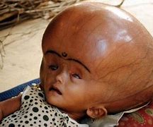Image result for The World's Biggest Head