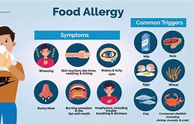 Image result for Apple Allergy Sign for Work