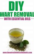 Image result for Essential Oils for Plantars Warts