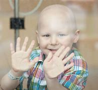 Image result for People with Leukemia
