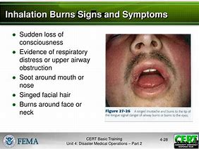 Image result for Oxonia Burn Sign