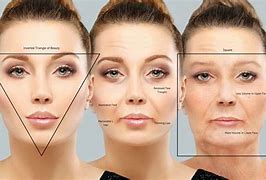 Image result for Face in Cheeks