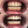 Image result for Best Place to Get Teeth Whitened