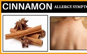 Image result for Cinnamon Allergy