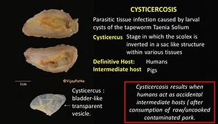 cysticercosis 的图像结果
