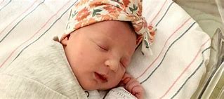 Image result for Oldest Survibing Baby with Anencephaly