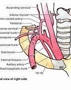 Image result for Subclavian Artery